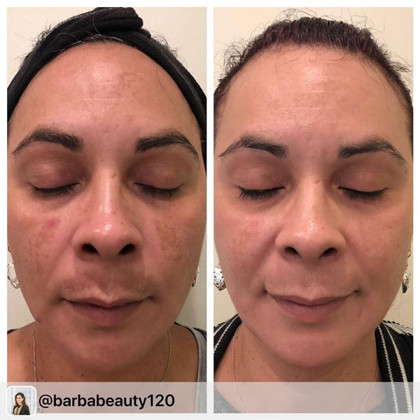 47190231_510576209439375_363625314766525398_n