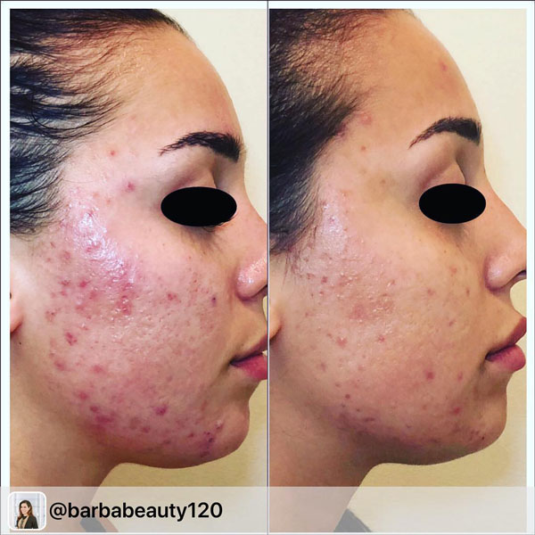 52912026_147490776283752_5672677303262308897_n